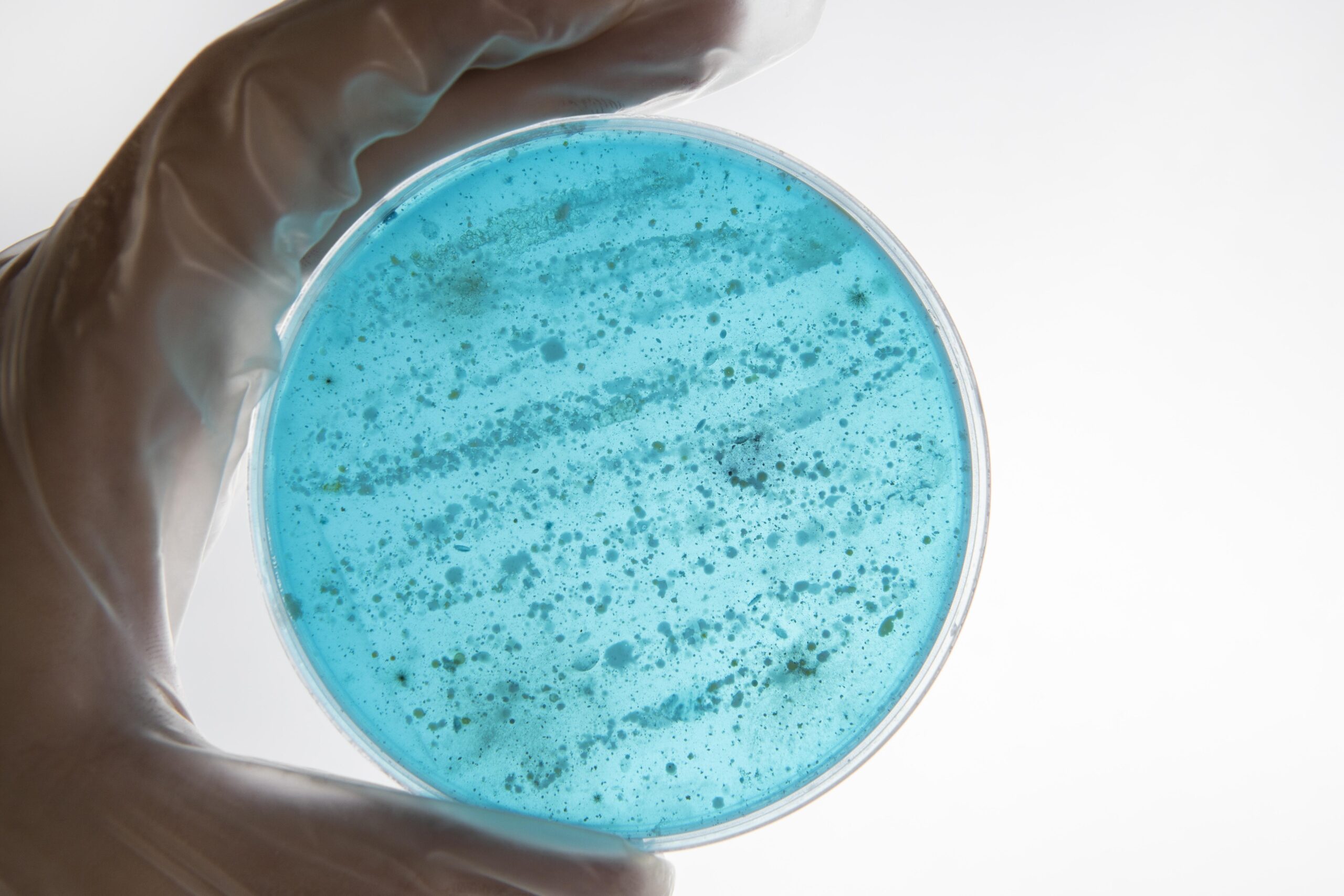 Pneumonia, meningite e sepse: antibiótico errado pode agravar quadros e acelerar a resistência antimicrobiana